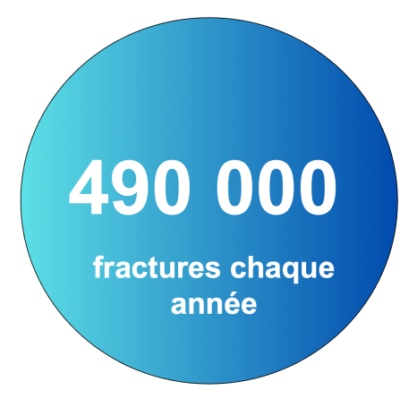 Cercle bleu affichant "490 000 fractures chaque année".